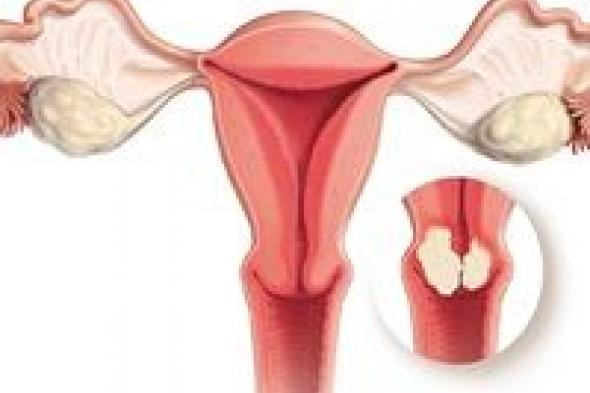 أبرزها سرطان الثدي.. 4 أنواع سرطان تصيب النساء