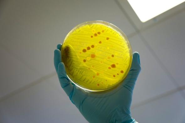 فريق بحثي سعودي يطور علاجات طبيعية لمقاومة البكتيريا