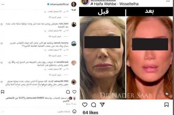 ظهور صادم لريهام سعيد بعد عملية تجميل: «وشي اتحرق وكله متخيط» (فيديو)