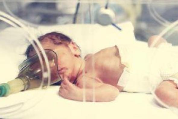 طبيب يوضح السبب الرئيسى لدخول الأطفال حديثى الولادة الحضانة