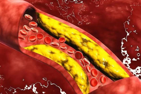 الامارات | كيف يمكن أن تتحكم في مستوى الكولسترول بدون أدوية؟
