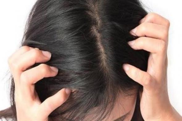 خبراء يكشفون عن 5 علامات على فروة الرأس تدل على الإصابة بالسرطان