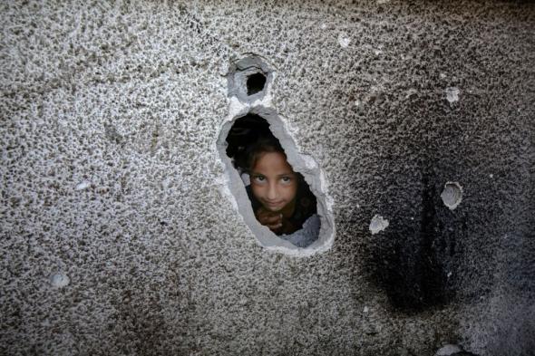 تسجل عشرات حالات سوء تغذية بين الأطفال في غزة