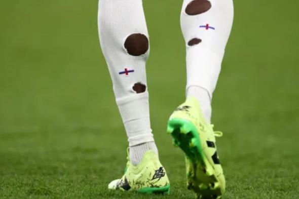 الامارات | لماذا يرتدي اللاعبون جوارب مثقوبة في كأس أمم أوروبا ؟